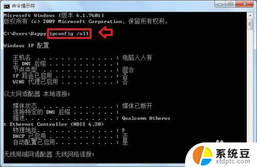 电脑wifiip地址怎么设置 无线网络IP地址设置技巧